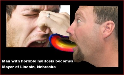 Halitosis bad breath