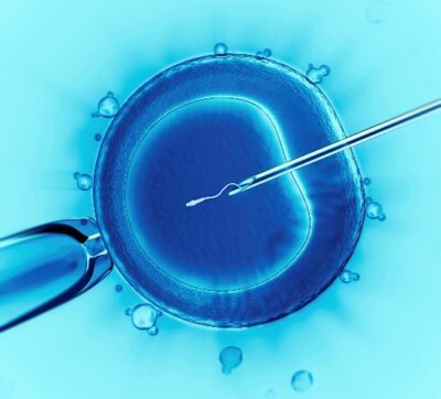IVF, In Vitro Fertilization